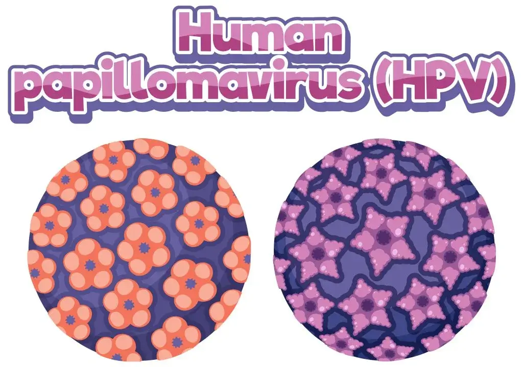 Human Papiloma Virus