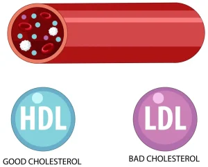 Types of Cholesterol HDL and LDL