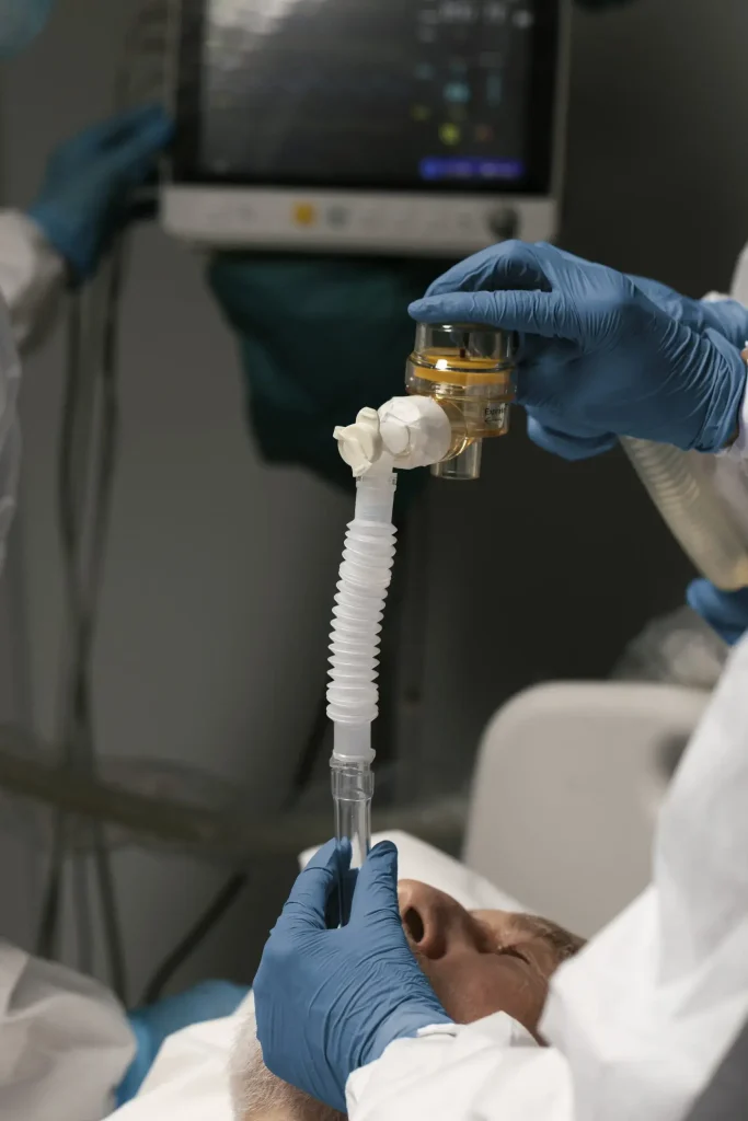 تهویه ی مصنوعی در ICU
